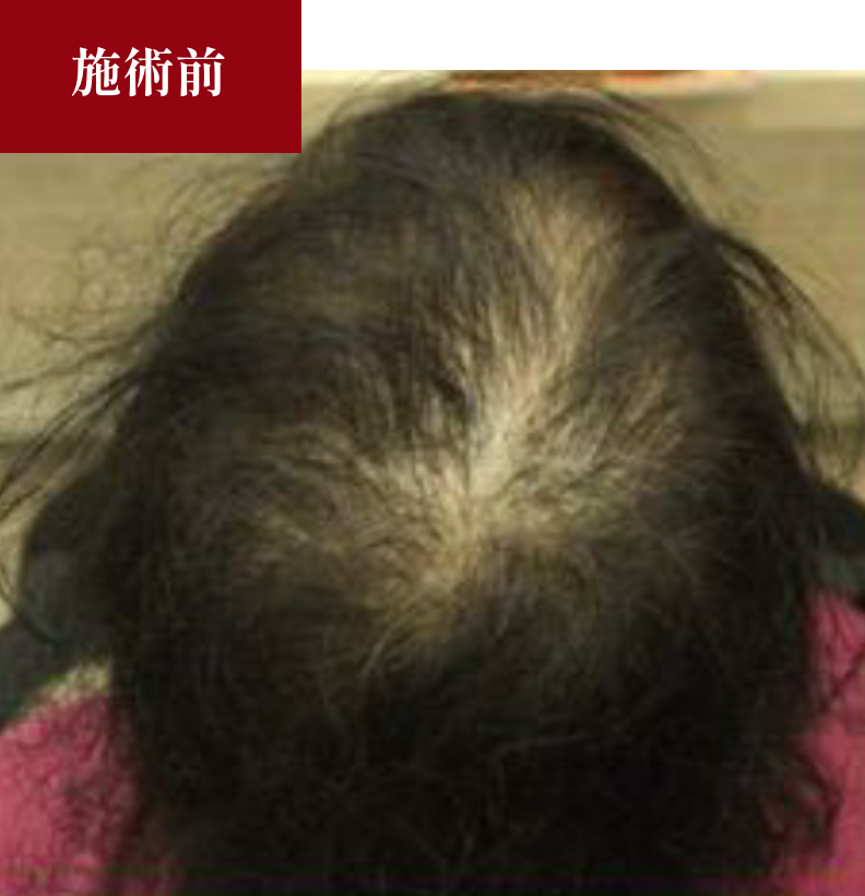 BeforeAfter 施術前
